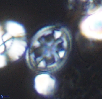 Axopodorhabdus albianus 8416