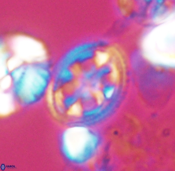 Axopodorhabdus albianus 8417