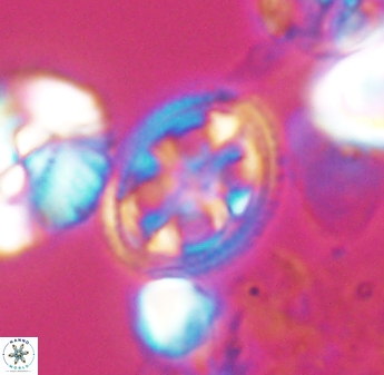 Axopodorhabdus albianus 8417