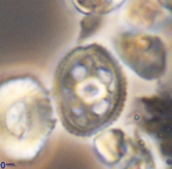 Axopodorhabdus albianus 8418