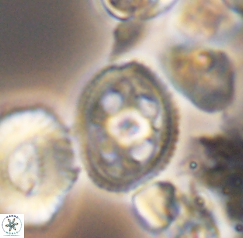 Axopodorhabdus albianus 8418