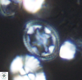 Axopodorhabdus albianus 8412