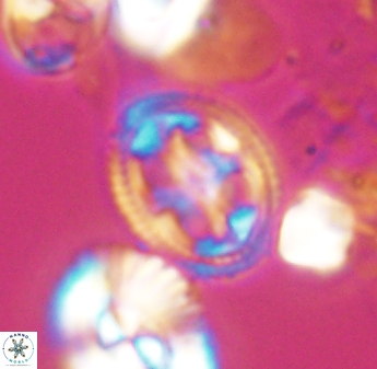 Axopodorhabdus albianus 8413