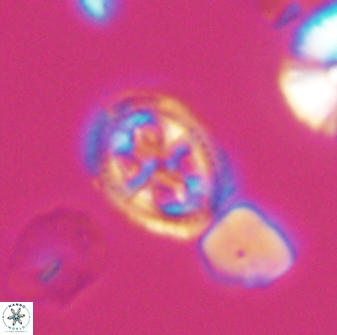 Axopodorhabdus albianus 8524
