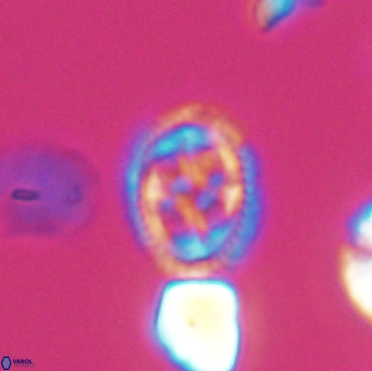 Axopodorhabdus albianus 8525