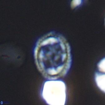 Axopodorhabdus albianus 8526