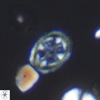 Axopodorhabdus albianus 8527