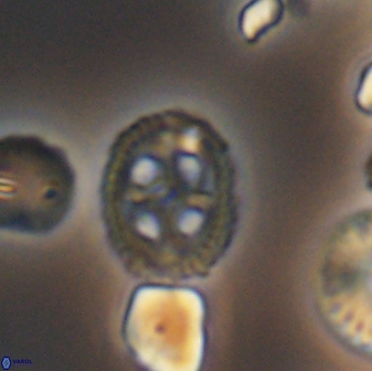 Axopodorhabdus albianus 8529