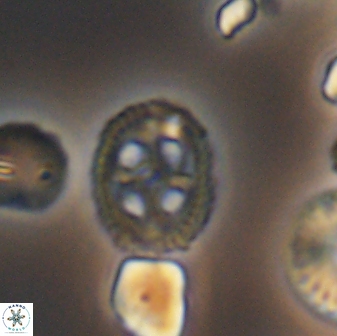 Axopodorhabdus albianus 8529