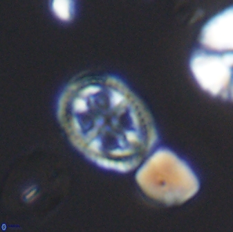 Axopodorhabdus albianus 8523