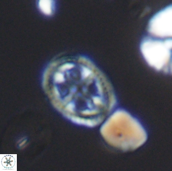Axopodorhabdus albianus 8523