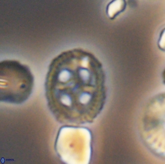 Axopodorhabdus albianus 8530