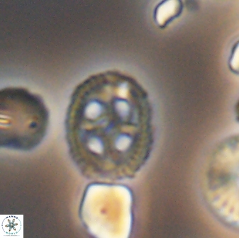 Axopodorhabdus albianus 8530