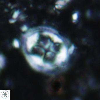 Axopodorhabdus albianus 936