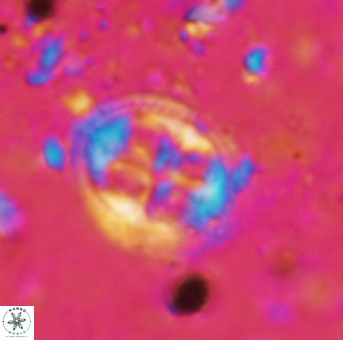 Axopodorhabdus albianus 937