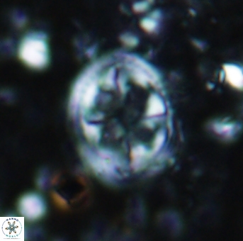 Axopodorhabdus albianus 939