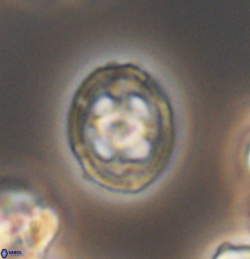 Axopodorhabdus albianus 11275