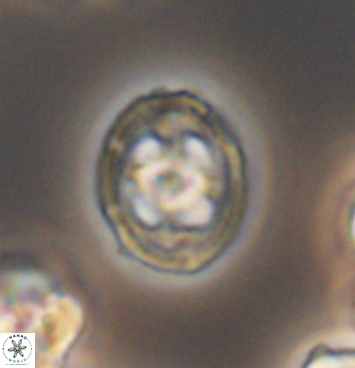 Axopodorhabdus albianus 11275