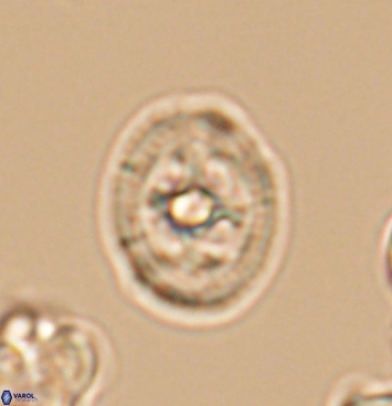 Axopodorhabdus albianus 11276