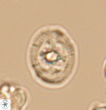 Axopodorhabdus albianus 11276