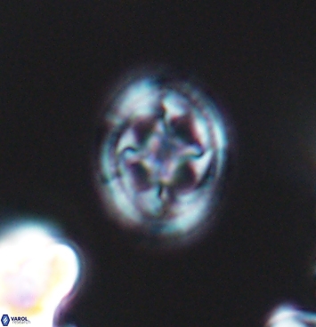 Axopodorhabdus albianus 11277