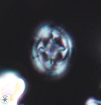 Axopodorhabdus albianus 11277