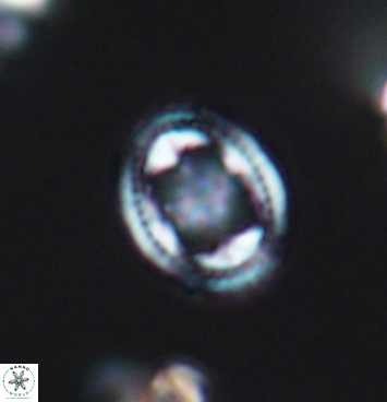 Axopodorhabdus albianus 11279