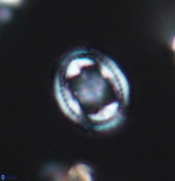 Axopodorhabdus albianus 11280