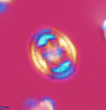 Axopodorhabdus albianus 11281