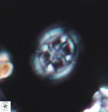 Axopodorhabdus albianus 11282