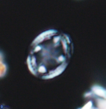 Axopodorhabdus albianus 11285