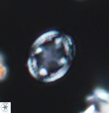 Axopodorhabdus albianus 11285