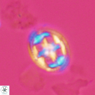 Axopodorhabdus albianus 12802