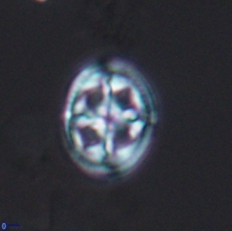 Axopodorhabdus albianus 12803