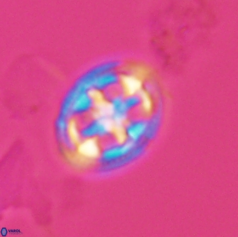 Axopodorhabdus albianus 12806