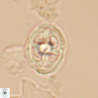 Axopodorhabdus albianus 12807
