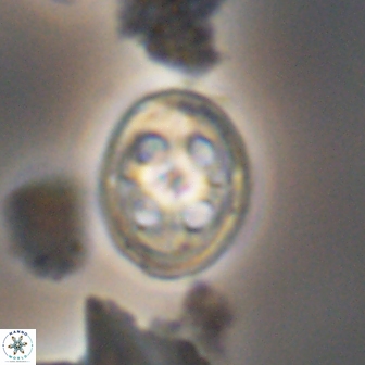 Axopodorhabdus albianus 12809