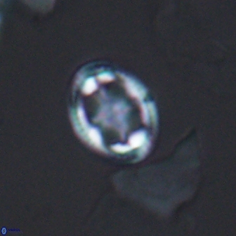 Axopodorhabdus albianus 12811