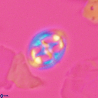 Axopodorhabdus albianus 12816