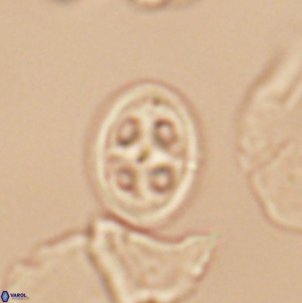 Axopodorhabdus albianus 12817