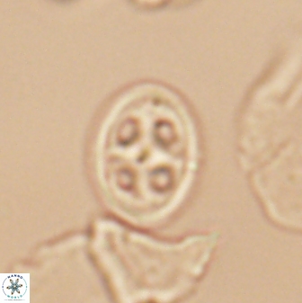 Axopodorhabdus albianus 12817
