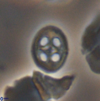 Axopodorhabdus albianus 12818