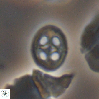 Axopodorhabdus albianus 12818