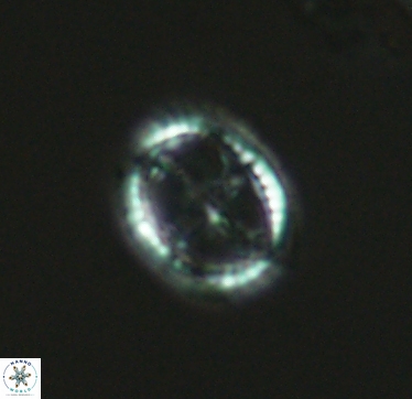Axopodorhabdus cylindratus 2955