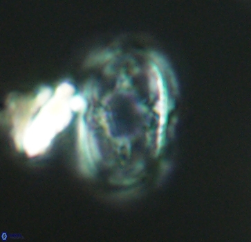 Axopodorhabdus dietzmannii 2810