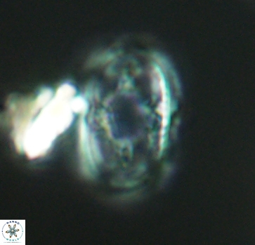 Axopodorhabdus dietzmannii 2810