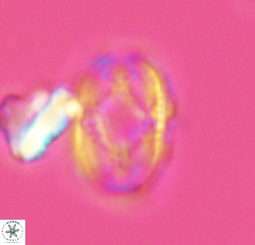 Axopodorhabdus dietzmannii 2811