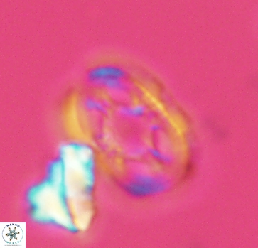 Axopodorhabdus dietzmannii 2812