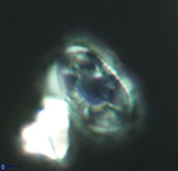 Axopodorhabdus dietzmannii 2813