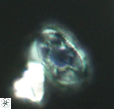Axopodorhabdus dietzmannii 2813